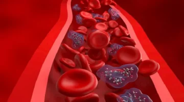 أطعمة طبيعية تحمي القلب والشرايين وتساعد في تنظيم مستويات ضغط الدم